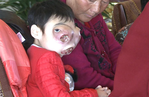 父辈残杀貉子和貂, 8岁女儿惨遭报应; 29岁女子邪婬不孝果报惨烈 (近期果报三则) 多图, 大力推荐 - 阳光师姐 - 阳光师姐的清净之疆网易博客,欢迎来访!